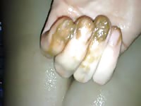 Amateur plays with his poop
