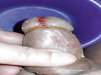 Pain cbt insertion bdsm extrem pervers maggots eating cock