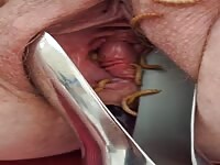 Speculum play